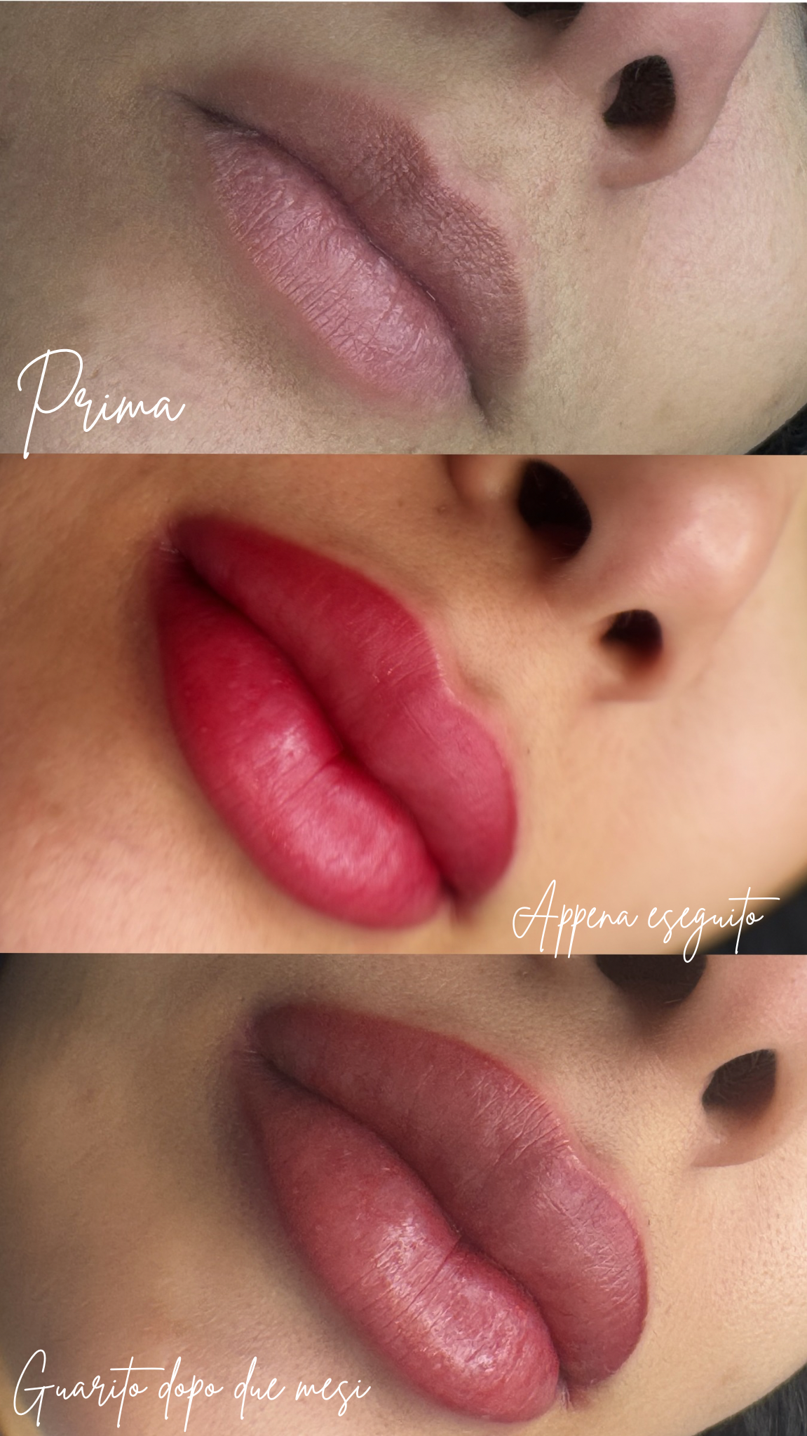 Trucco permanente labbra